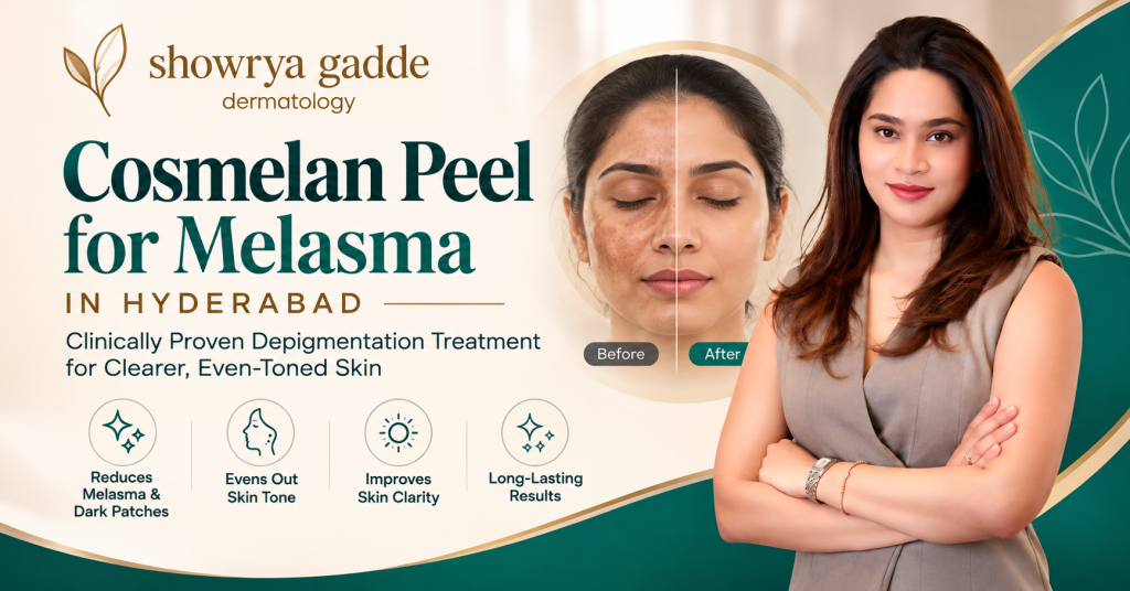 Cosmelan Peel in Hyderabad