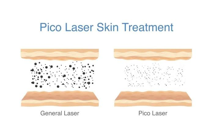 What Is a Pico Laser